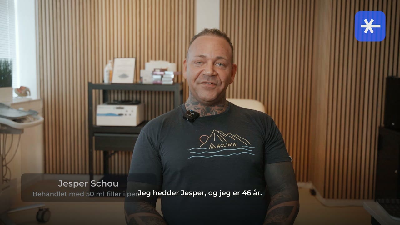 Jesper fortæller om sin penis filler behandling